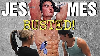I Have Proof He's Not Natty || Jesse James West