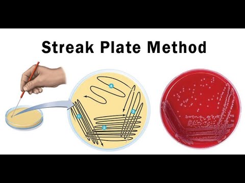 What two colors of streak plate should you use when doing a streak test?