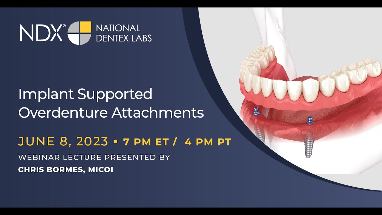 Implant Supported Overdenture Attachments - YouTube