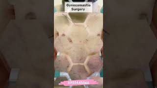 Gynecomastia treatment without surgery | Gynecomastia Treatment with VASER |