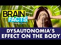 What is Dysautonomia? | Brain Facts #shorts