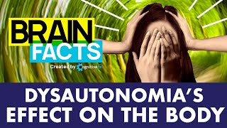 What is Dysautonomia? | Brain Facts #shorts