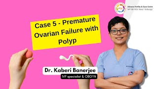 Case 5 - Premature Ovarian Failure with Polyp (Donor Egg IVF with Polyp Removal)