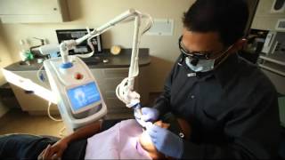 Solea CO2 Laser | Laser Dentistry | Redondo Beach Dental Group