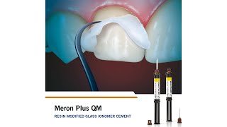 Meron Plus QM - resin modified Glass Ionomer Cement with tack-cure option