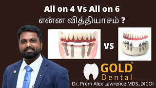 All on 4 Vs All on 6 Implants | Dr. Prem explains in Tamil | All on 4 Vs All on 6 Implants |Dr. Prem