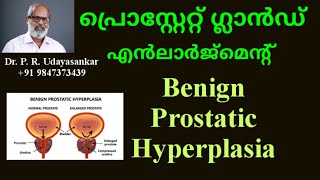 പ്രൊസ്റ്റേറ്റ് ഗ്രന്ഥിയ്ക്കുണ്ടാകുന്ന വീക്കം || Benign Prostatic Hyperplasia || Dr.P.R. Udayasankar