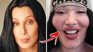 BOTCHED Celebrities Who Destroyed Their Careers With Plastic Surgeries