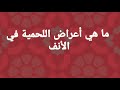 لحميات الانف.. انواع. اعراض. اسباب.. وقاية. علاج.. د محمد القرشلي لايك و أشتراك للقناة