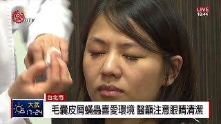 假睫毛清潔沒做好 當心堆細菌引發角膜炎 2019-03-15 IPCF-TITV 原文會 原視新聞