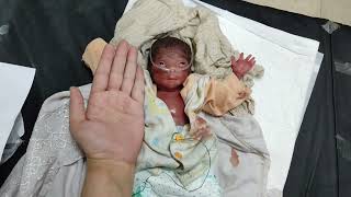 Smallest newborn baby after birth || so beautiful and active || born at 22 weeks #small