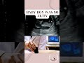 cute baby ultrasound pregnancy infertility pregnant pregnancy baby pregnancytips shorts ttc