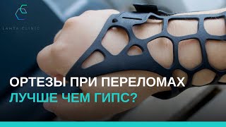 Ортезы при переломах: лучше чем гипс?