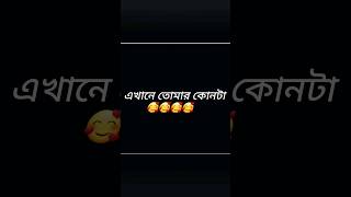 এখানে তোমার কোনটা 🥰🥰🥰🥰