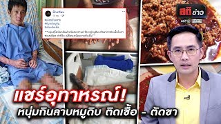 แชร์อุทาหรณ์! หนุ่มกินลาบหมูดิบ ตัดขาเพื่อต่อชีวิต | สติข่าว | ข่าวช่องวัน | one31