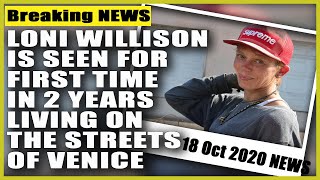 Loni Willison is seen for first time in 2 years living on the streets of Venice.