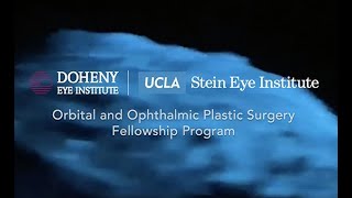 UCLA Oculoplastics 2020