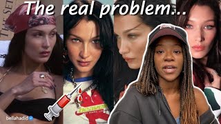 Bella Hadids PLASTIC SURGEON turned her into a SUPERMODEL