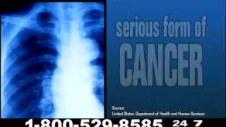 Mesothelioma Lawyers