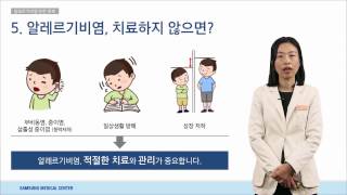 알레르기 완전 정복_소아청소년과 김지현 교수[의료진 ON Line 강의]