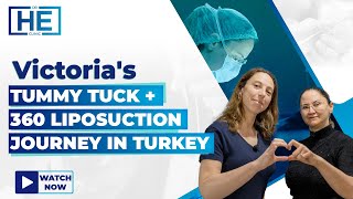 Victoria's Tummy Tuck + 360 Liposuction Journey in Turkey | Dr HE Clinic