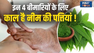 Neem Leaves Benefits: इन 4 बीमारियों के लिए काल है नीम की पत्तियां, सेहत हो जाएगी चुस्त-दुरुस्त !