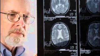 AGING 101: Pt 6 Stroke
