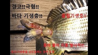 극혐!! 바다 기생충 물고기에서 떼어내기~!!(Parasite removal)