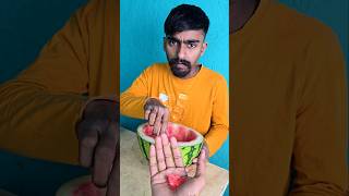 Kind Brother Shares Watermelon with His Brother 🍉❤️