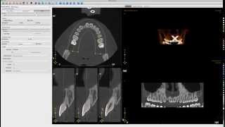 2D and 3D Interactive Data Visualization using Python | Enthought Software Development