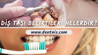 Diş Taşı Belirtileri Nelerdir?