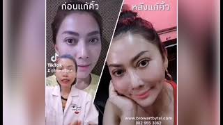 รีวิวลบคิ้วด้วยน้ำยารีจ​ู​วี่​ by​อาจารย์​ต่าย