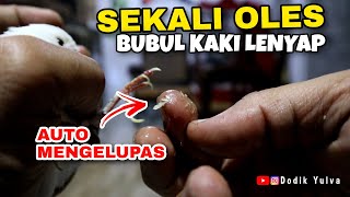 CESPLENG SEMBUH..!!! Mengobati Kaki Kenari Dengan Obat Pasar