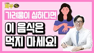 만성 두드러기로 가려울 때 '좋은 음식' VS '나쁜 음식' 한방에 정리해 드립니다 - 박치영의 피부 톡톡 #79