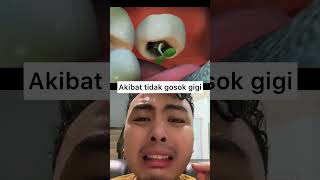 Ini lah guys akibat tidak rajin menggosok gigi! Kalian rajin gosok gigi gak? #shorts