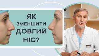 ДОВГИЙ НІС 🤥 ЯК ЗМЕНШИТИ НІС — РИНОПЛАСТИКА АБО ІН’ЄКЦІЇ?