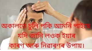 অকালতে চুলি পকি আমনি পাইছে যদি জানি লওঁক ইয়াৰ কাৰণ আৰু নিৱাৰণৰ উপায়।#assamese