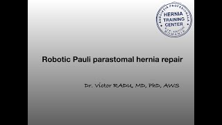 Parastomal Hernia - robotic Pauli repair