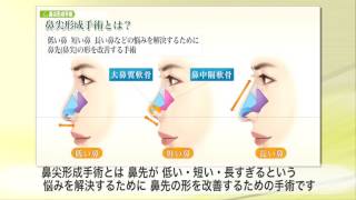 【東京美容外科】わかりやすい“鼻”の解説08「鼻尖形成手術とは？」