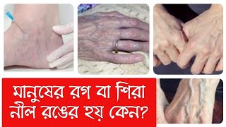 মানুষের রক্ত লাল রঙের হলেও রগ কেন নীল রঙের হয় জানেন?