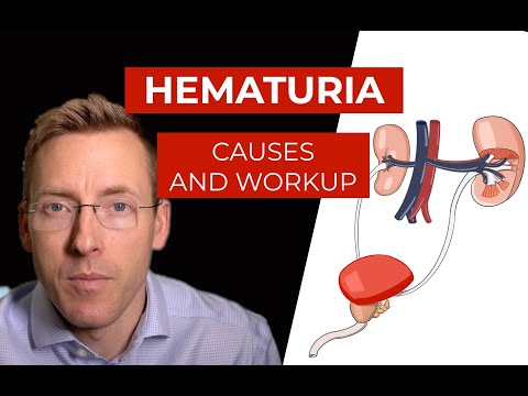 How does hypertension cause hematuria?