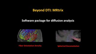 Introduction to MRtrix