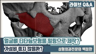 얼굴뼈 티타늄보형물 밀링으로 제작하면 어떨까요?