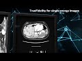 what s new with ct at ge healthcare