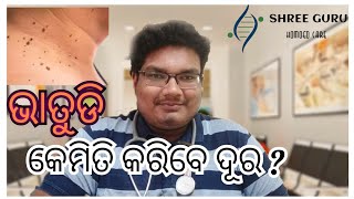 ଭାତୁଡ଼ି ସମସ୍ୟାରୁ କେମିତି ପାଇବେ ମୁକ୍ତି ? | Warts : How to treat in odia |Dr.Sandeep kumar sahoo