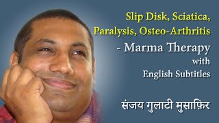 0018 Sciatica, Slip Disk, Paralysis - Marma Points (with Subtitles) - पक्षाघात में मर्म