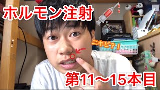 【洸希】ホルモン注射第11.12.13.14.15回目