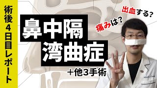 【鼻中隔湾曲症】他３つの鼻の手術しました【美容整形ではありません】