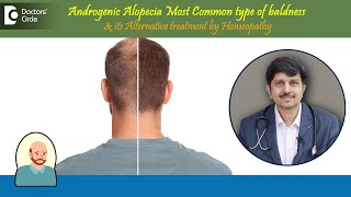 Baldness|Androgenic Alopecia|Alternative Treatment by Homeopathy -Dr.Sanjay Pani