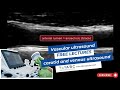 Vascular ultrasound free lectures: carotid and venous ultrasound